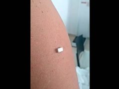 Vacunas contra covid ni atraen metales ni son imanes