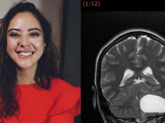 Joven teziuteca pide apoyo para costear operación de tumor cerebral