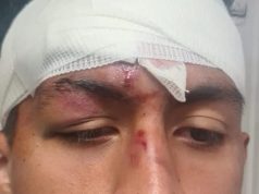 Hijo de funcionaria de Puebla golpeó brutalmente a joven durante partido de fútbol; temen tráfico de influencias