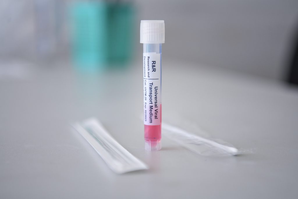 Registra Puebla 31 hospitalizados por COVID-19: Salud