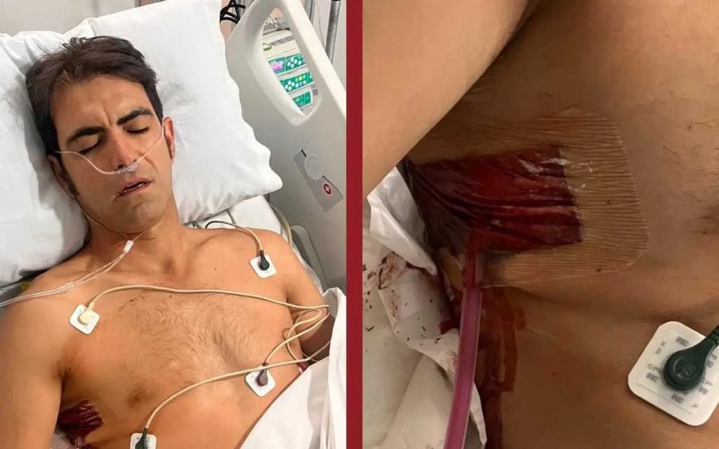 Torero Arturo Macías, en terapia intensiva tras cornada en Aguascaliente